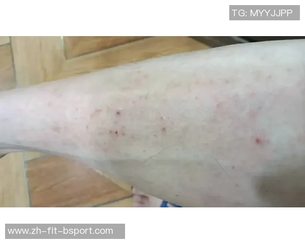 足球网的窟窿眼儿数量究竟有多少对比赛结果影响深远吗